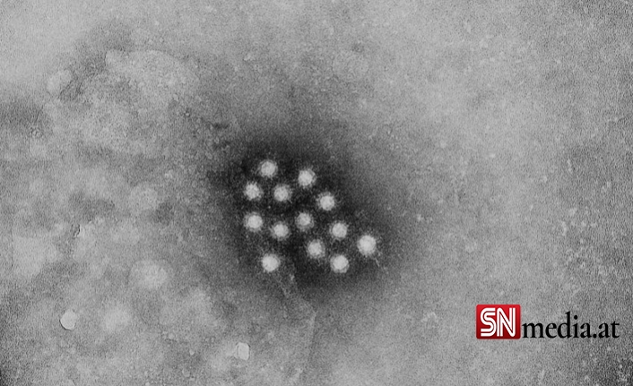 DSÖ, 348 Kişide Görülen ve Nedeni Açıklanamayan Hepatit Vakalarında Korona Virüsün Rolünü Araştırıyor